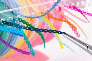 A close-up of orthodontic elastic bands, showing how they are used to help align teeth and correct bite issues