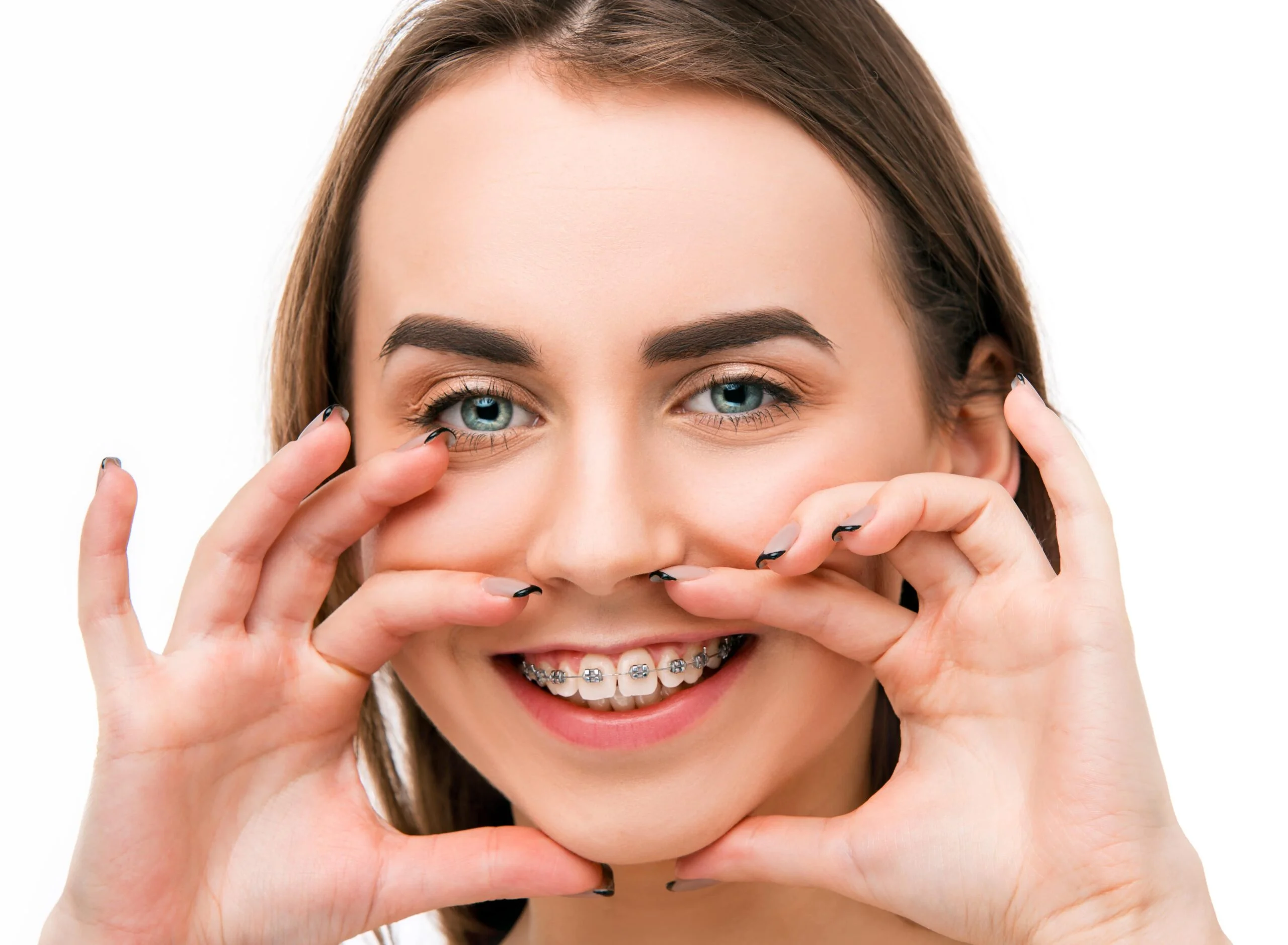 Metal and Ceramic Braces at Corona District New York