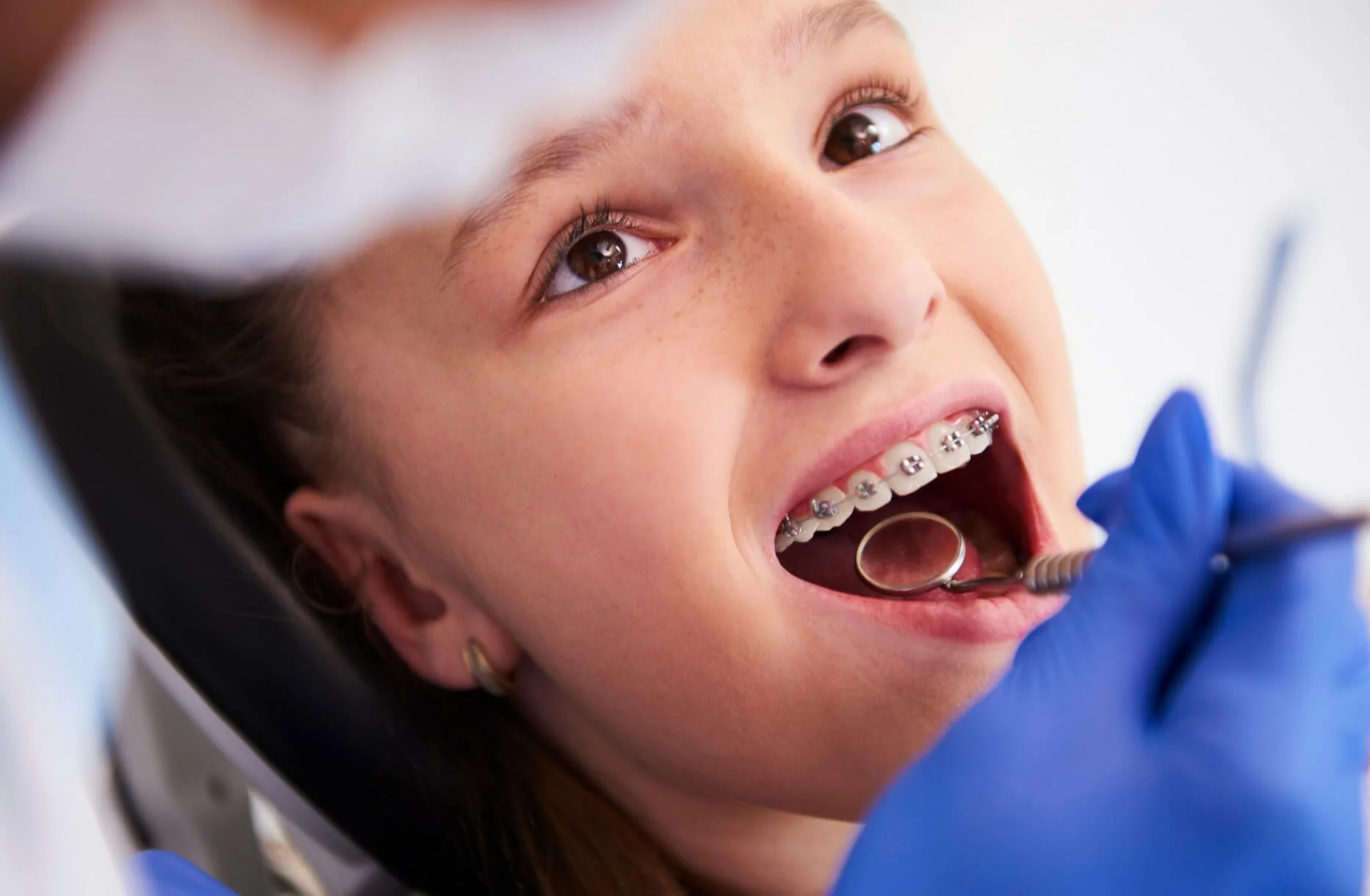 Metal and Ceramic Braces at Jackson Heights Orthodontics