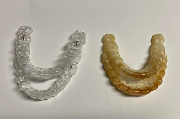 how clean retainer has plaque