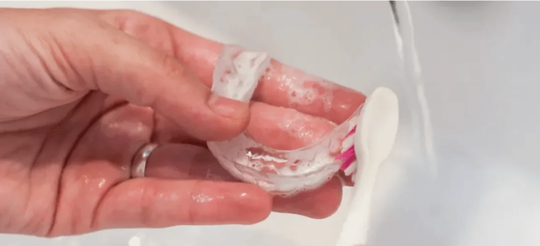 How to clean a retainer for proper oral hygiene