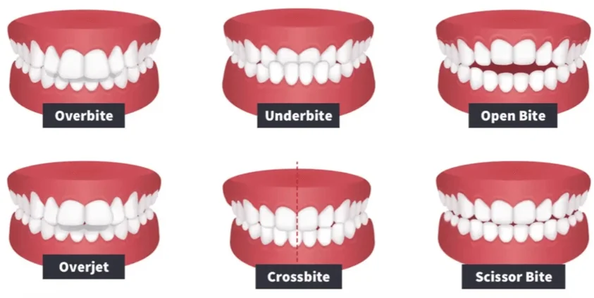 Basic methods and approaches to bite correction in orthodontics