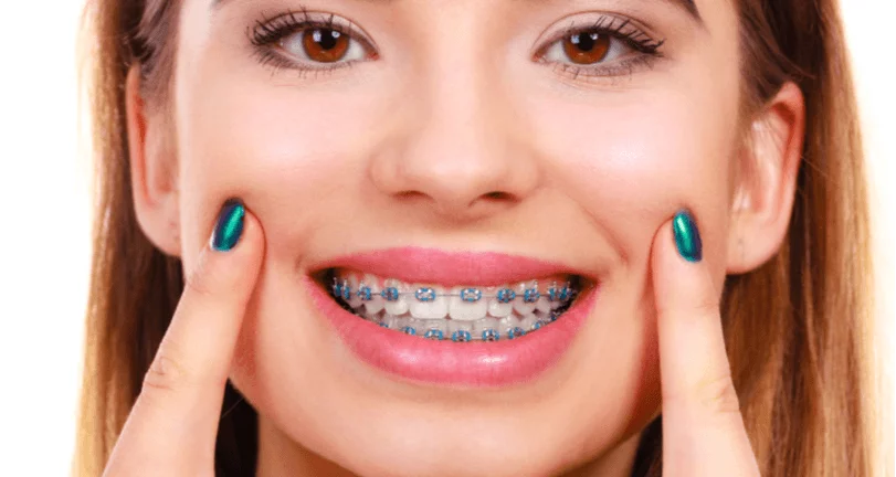 Maintaining healthy gums with braces for optimal oral health